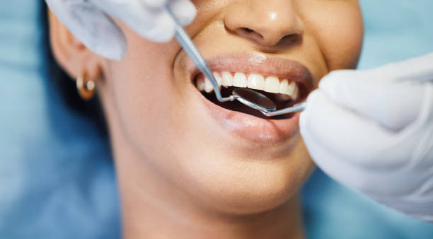 Best Broken or Cracked Tooth Emergency Dentist in Timnath, CO